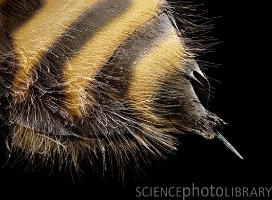Опасные насекомые под микроскопом (12 фотографий), photo:2