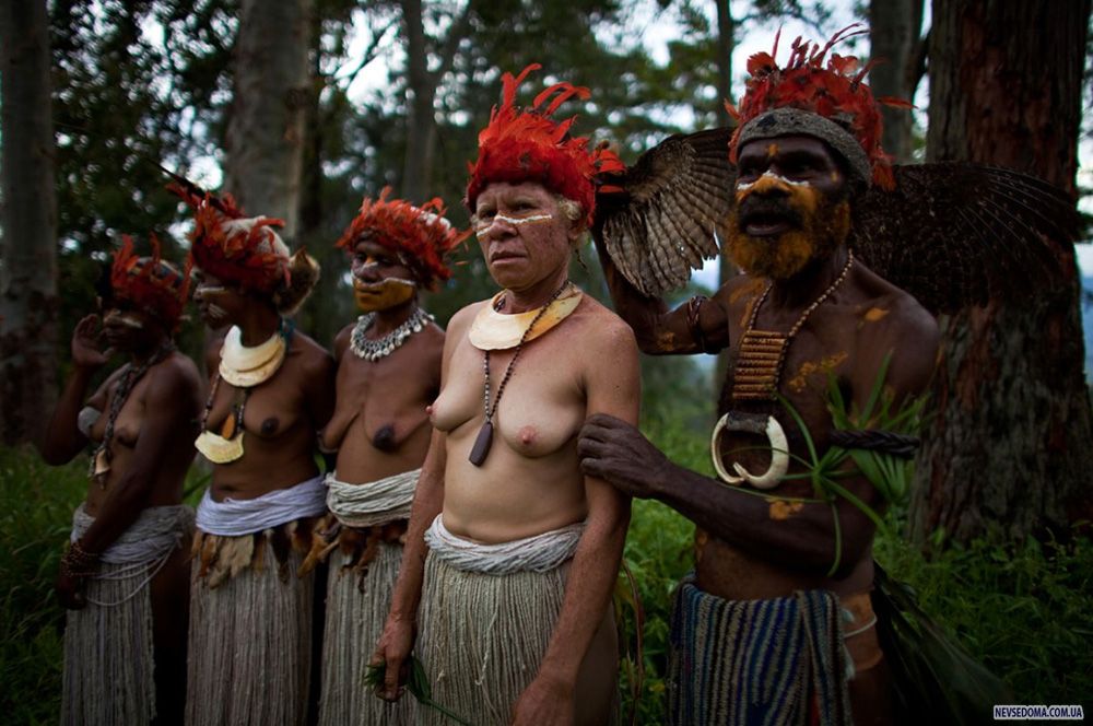 6.         ,   . (Brent Stirton/Getty Images)