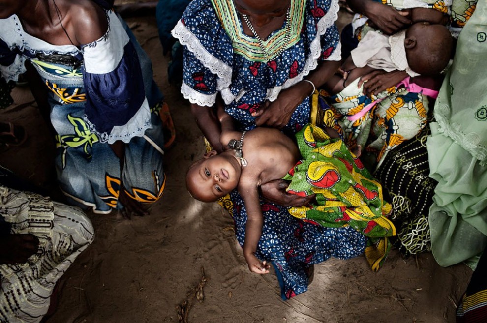 nigerfoodcrisis01 990x657    