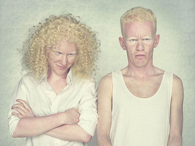 голый парень альбинос