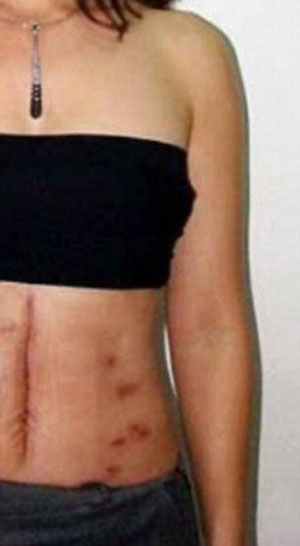 Мария Сантос показала свое изуродованное тело: ее пытались убить два раза