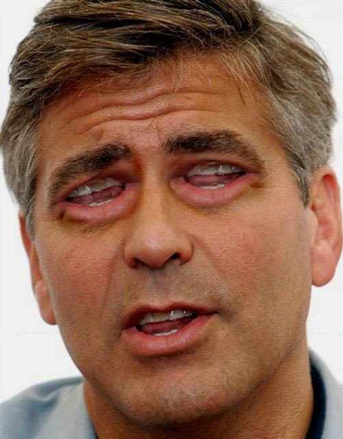 Жесть. Глазорты (24 Фото)