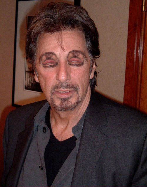 Жесть. Глазорты (24 Фото)